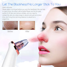 Load image into Gallery viewer, Electric Vacuum Suction Cleaner Face Cleaning Blackhead Removal Black Spot Facial Cleansing Machine Skin Scrubber Pore Cleanser for Beauty & Health