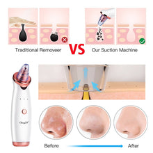 Load image into Gallery viewer, Electric Vacuum Suction Cleaner Face Cleaning Blackhead Removal Black Spot Facial Cleansing Machine Skin Scrubber Pore Cleanser for Beauty & Health